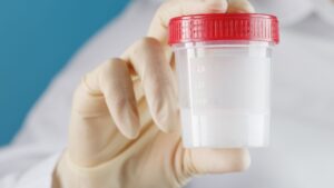 semen analysis provides information on sperm health and fertility