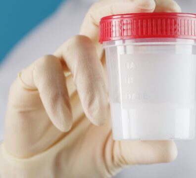 semen analysis provides information on sperm health and fertility